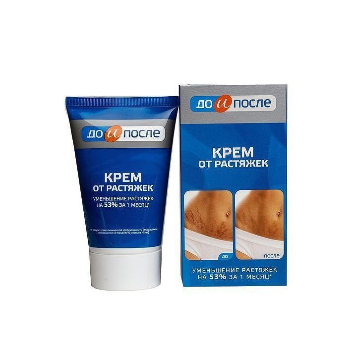 До и после 911 Крем против стрии 100 ml